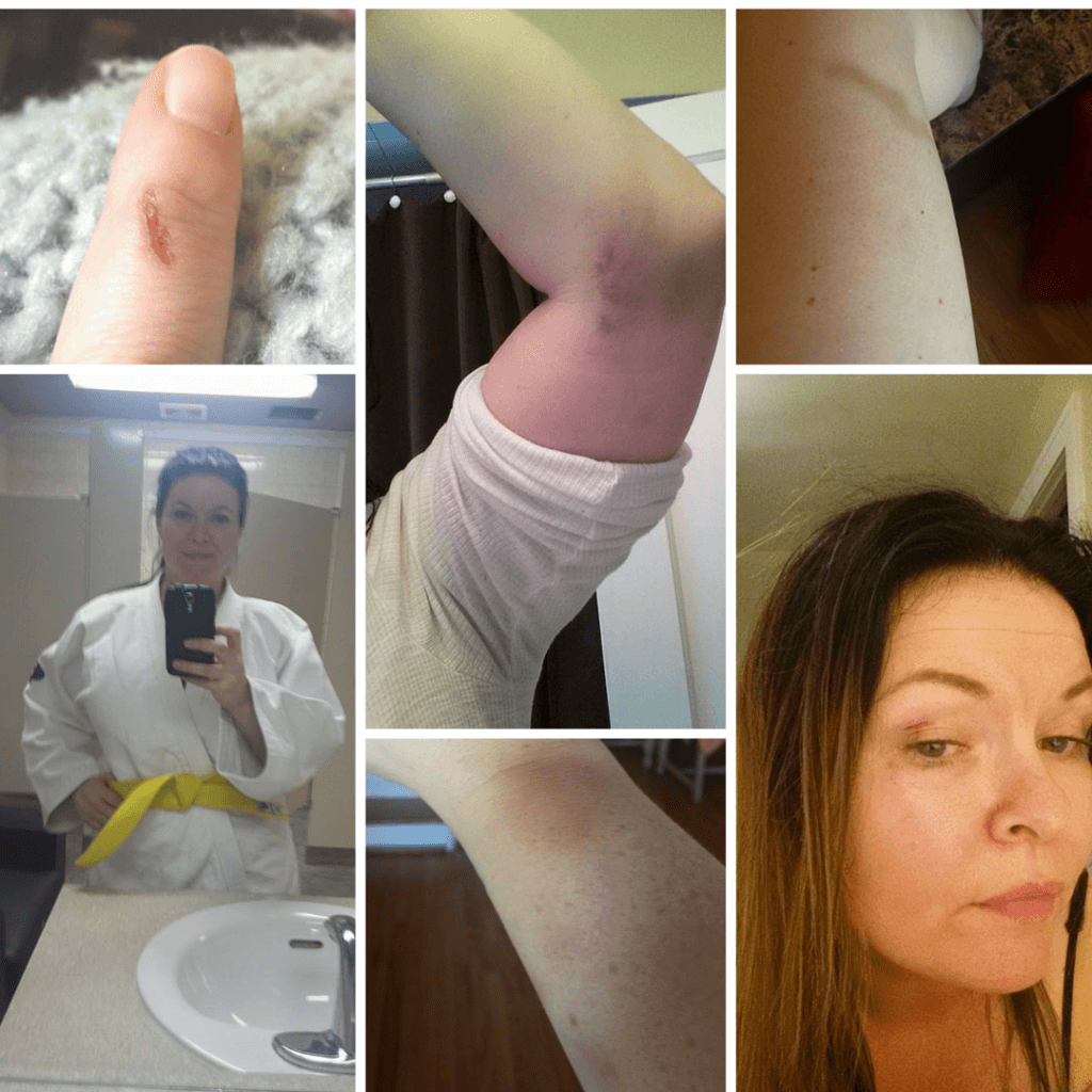 bruised not broken martial arts